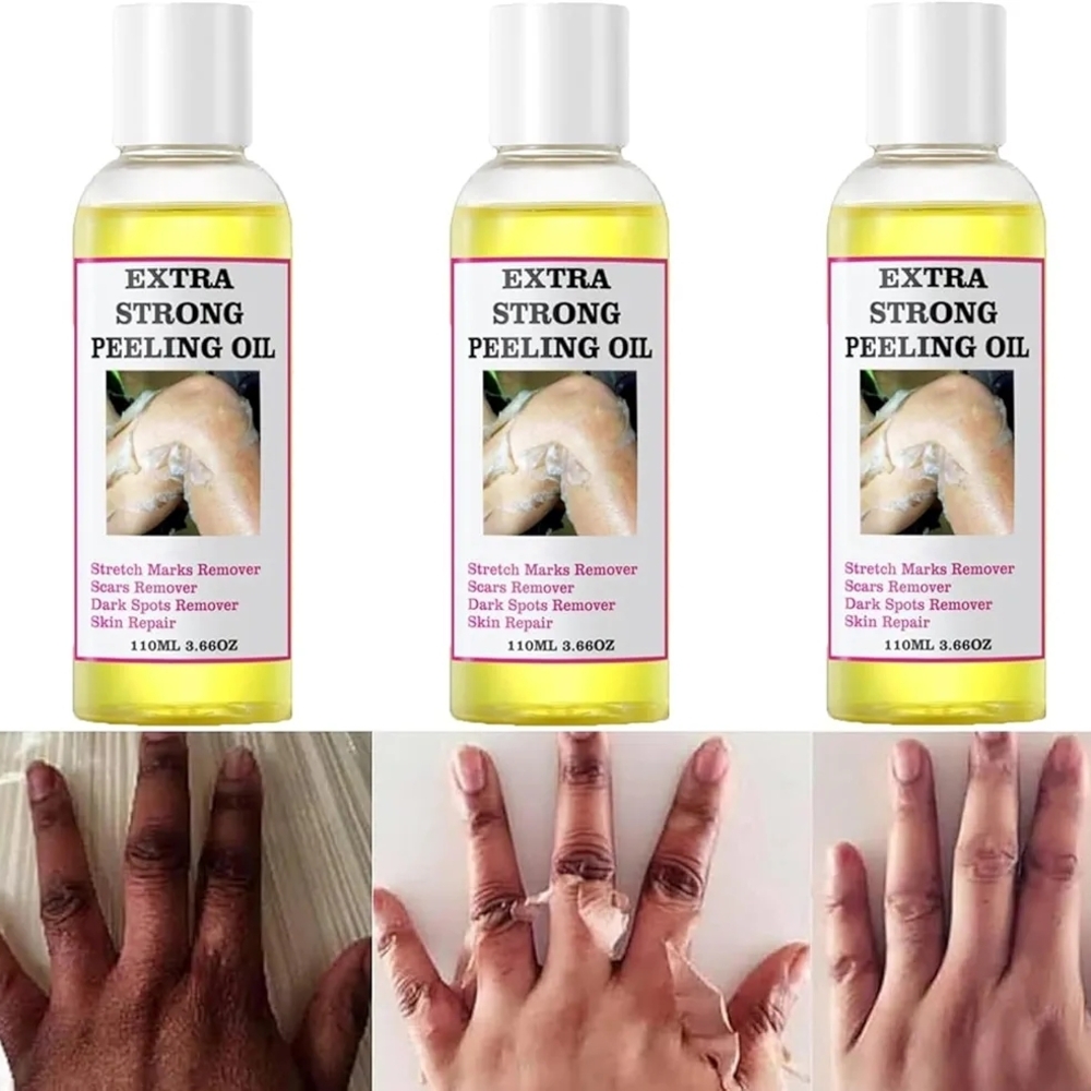 Extra Strong Peeling Oil 3 Packs